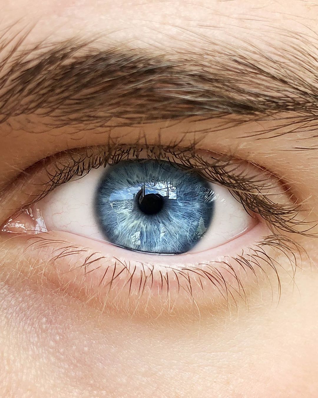 LASIK Houston SMILE Eye Surgery Houston IQ Laser Vision