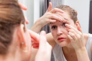 woman putting contact lenses in and its giving her a hard time because she has seasonal allergies
